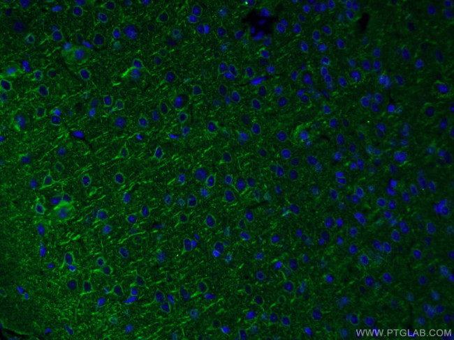 acetylated Tubulin(Lys40) Antibody in Immunohistochemistry (PFA fixed) (IHC (PFA))