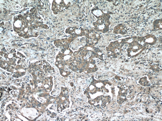 acetylated Tubulin(Lys40) Antibody in Immunohistochemistry (Paraffin) (IHC (P))