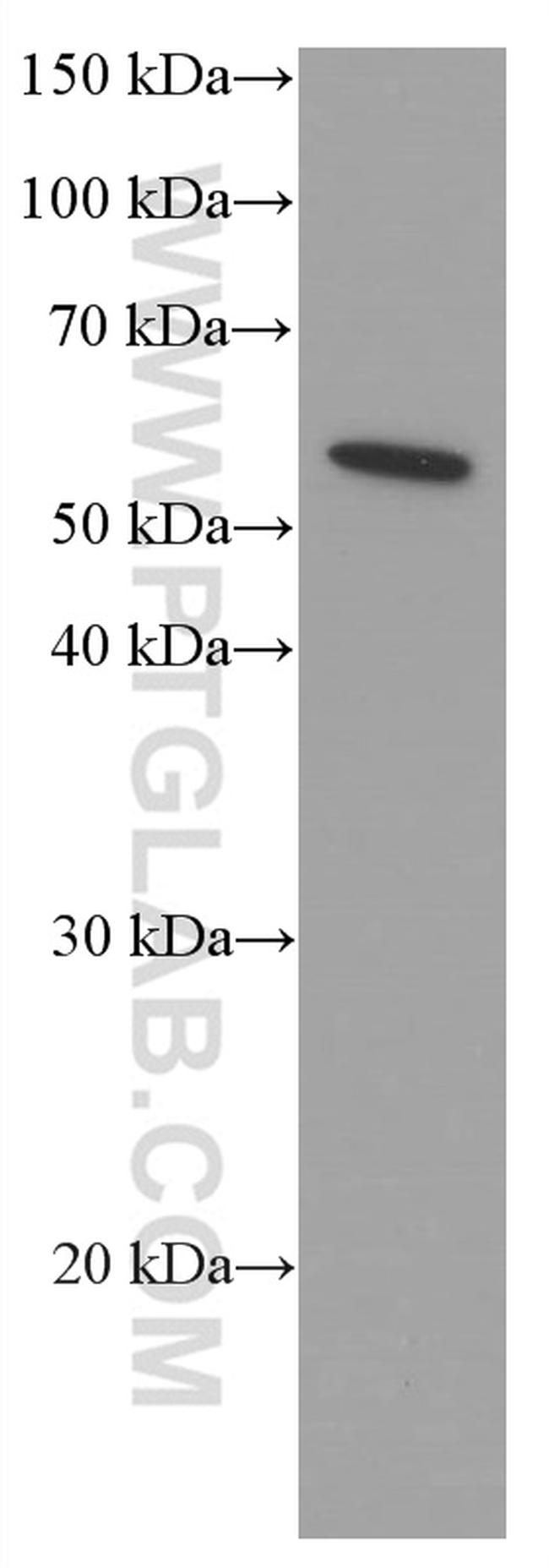 acetylated Tubulin(Lys40) Antibody in Western Blot (WB)