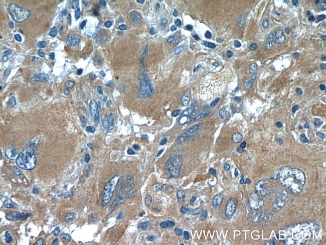 acetylated Tubulin(Lys40) Antibody in Immunohistochemistry (Paraffin) (IHC (P))