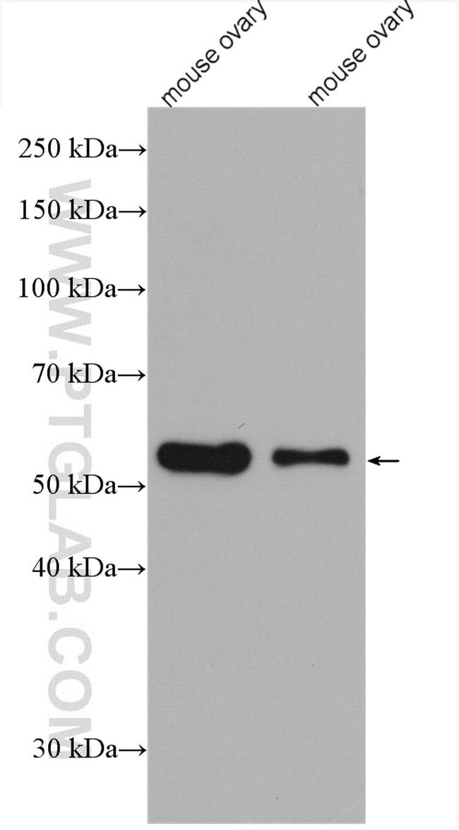 acetylated Tubulin(Lys40) Antibody in Western Blot (WB)