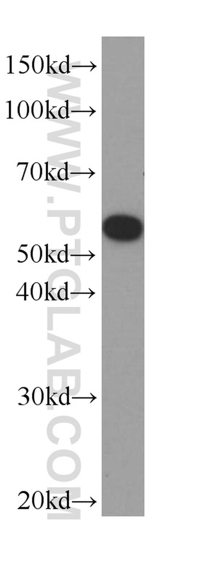 acetylated Tubulin(Lys40) Antibody in Western Blot (WB)