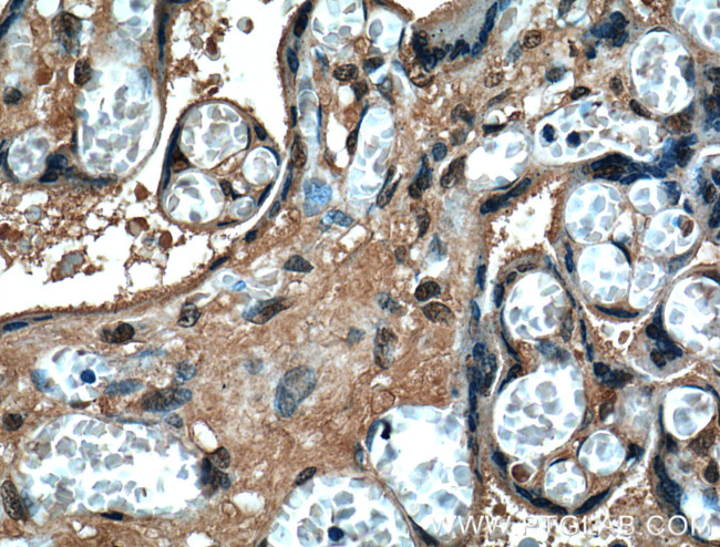 SERPINE2 Antibody in Immunohistochemistry (Paraffin) (IHC (P))