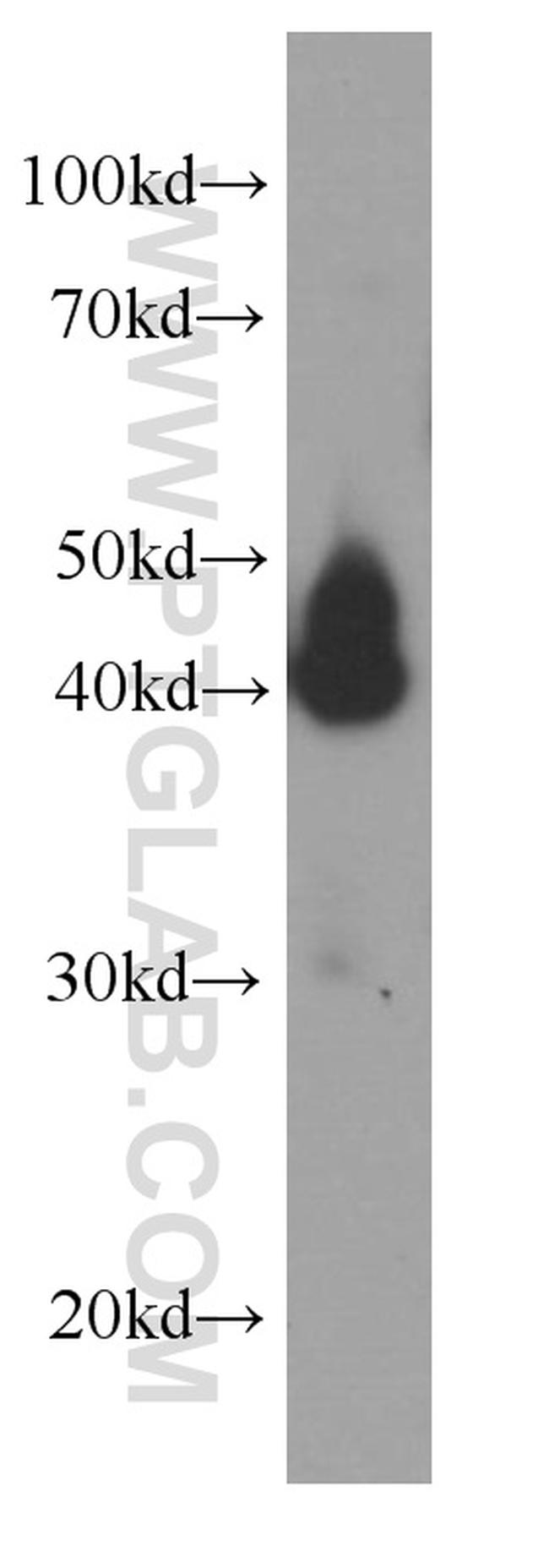 SERPINE2 Antibody in Western Blot (WB)