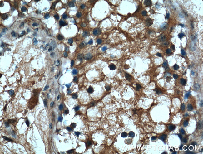 SERPINE2 Antibody in Immunohistochemistry (Paraffin) (IHC (P))