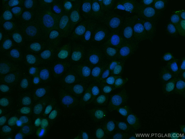 MCM2 Antibody in Immunocytochemistry (ICC/IF)