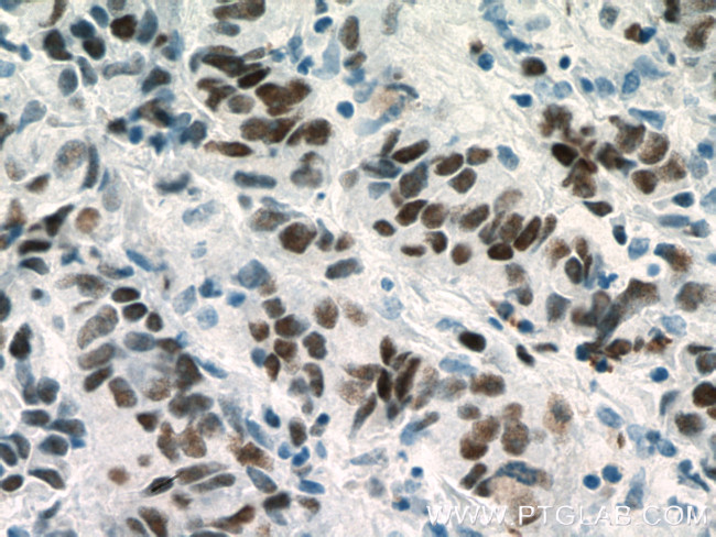 MCM2 Antibody in Immunohistochemistry (Paraffin) (IHC (P))