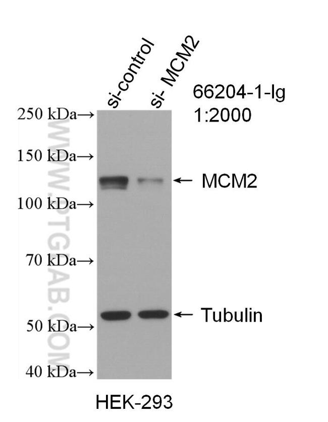 MCM2 Antibody in Western Blot (WB)