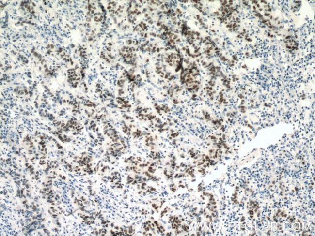 MCM2 Antibody in Immunohistochemistry (Paraffin) (IHC (P))