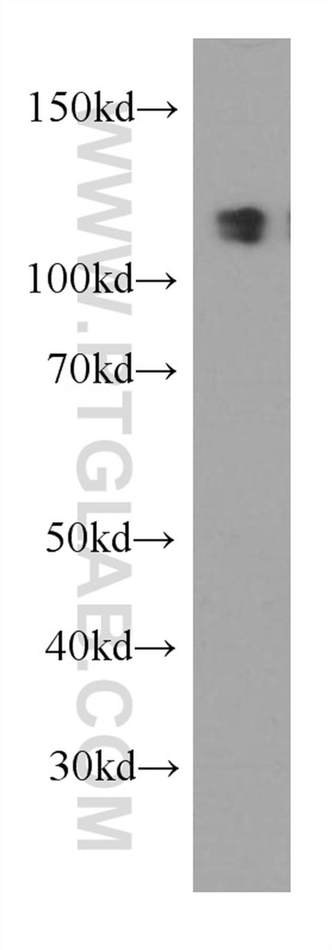 MCM2 Antibody in Western Blot (WB)