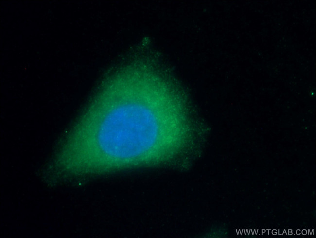 Apolipoprotein AI Antibody in Immunocytochemistry (ICC/IF)