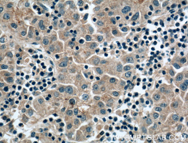 Apolipoprotein AI Antibody in Immunohistochemistry (Paraffin) (IHC (P))