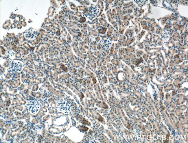 Apolipoprotein AI Antibody in Immunohistochemistry (Paraffin) (IHC (P))