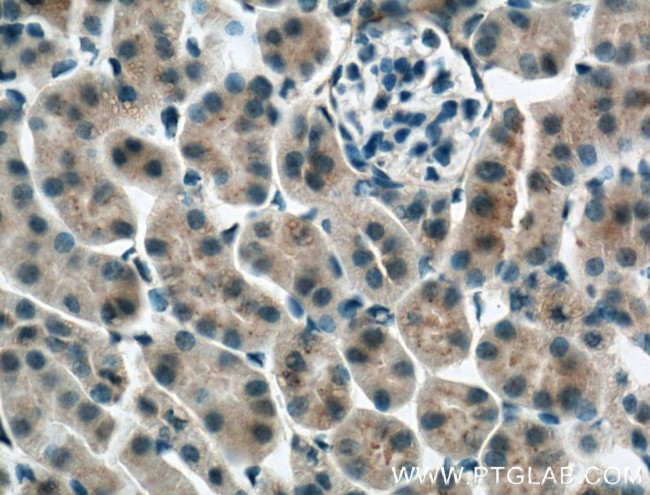 Apolipoprotein AI Antibody in Immunohistochemistry (Paraffin) (IHC (P))