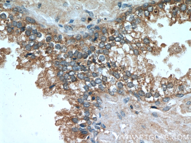 Beta-2-microglobulin Antibody in Immunohistochemistry (Paraffin) (IHC (P))