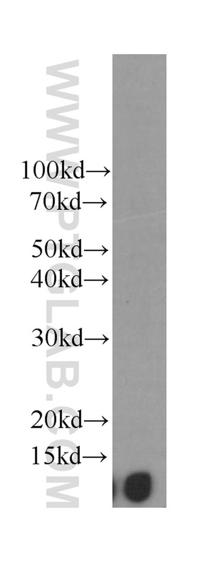 Beta-2-microglobulin Antibody in Western Blot (WB)