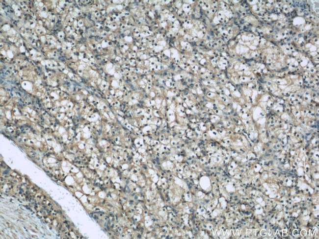 Beta-2-microglobulin Antibody in Immunohistochemistry (Paraffin) (IHC (P))