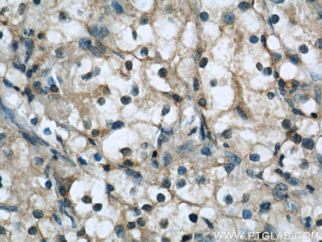 Beta-2-microglobulin Antibody in Immunohistochemistry (Paraffin) (IHC (P))