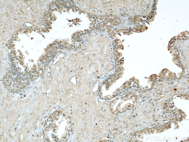 Beta-2-microglobulin Antibody in Immunohistochemistry (Paraffin) (IHC (P))