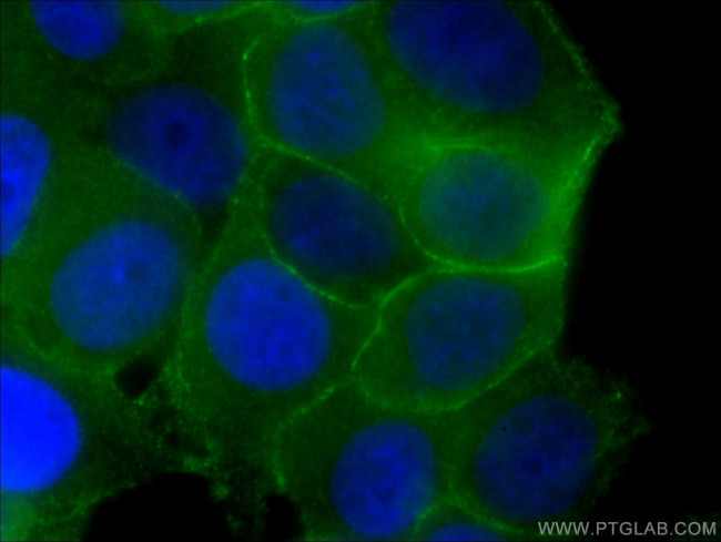 p120 Catenin Antibody in Immunocytochemistry (ICC/IF)