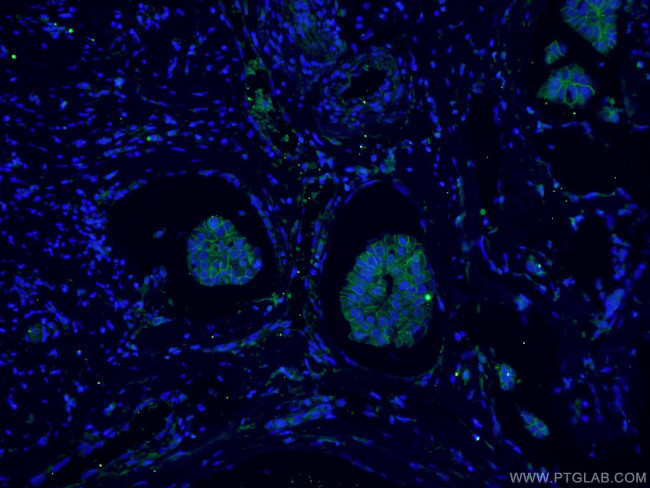 p120 Catenin Antibody in Immunohistochemistry (PFA fixed) (IHC (PFA))