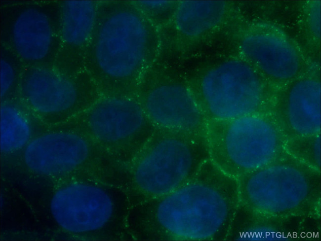 p120 Catenin Antibody in Immunocytochemistry (ICC/IF)