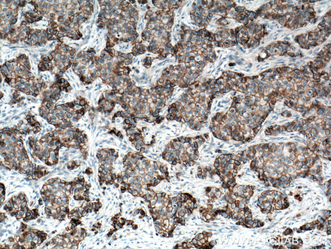 p120 Catenin Antibody in Immunohistochemistry (Paraffin) (IHC (P))