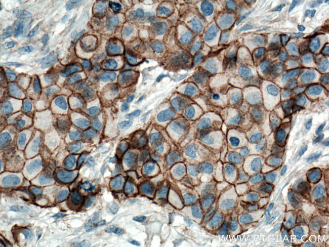 p120 Catenin Antibody in Immunohistochemistry (Paraffin) (IHC (P))