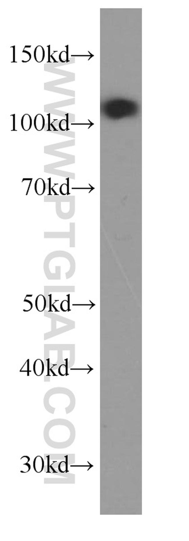 p120 Catenin Antibody in Western Blot (WB)