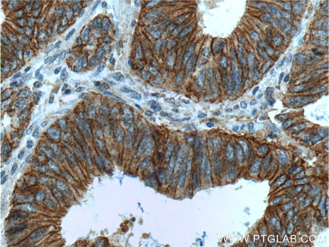 p120 Catenin Antibody in Immunohistochemistry (Paraffin) (IHC (P))