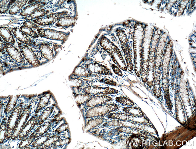 ST6GALNAC6 Antibody in Immunohistochemistry (Paraffin) (IHC (P))