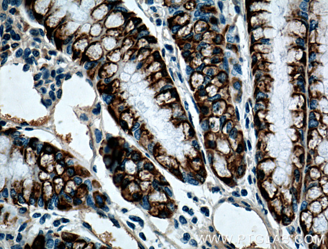 ST6GALNAC6 Antibody in Immunohistochemistry (Paraffin) (IHC (P))