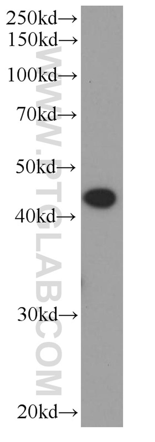 ST6GALNAC6 Antibody in Western Blot (WB)