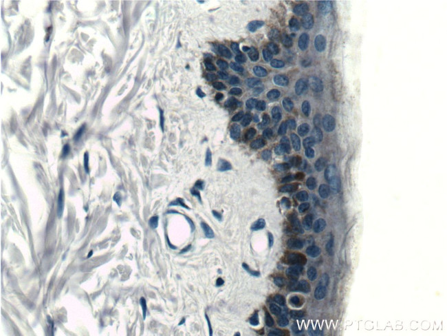 ST6GALNAC6 Antibody in Immunohistochemistry (Paraffin) (IHC (P))