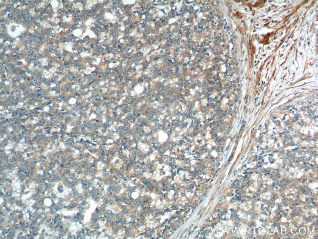 JNK Antibody in Immunohistochemistry (Paraffin) (IHC (P))