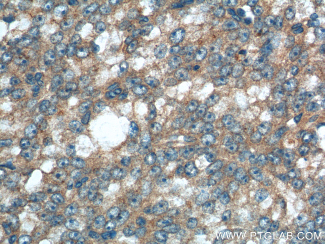 JNK Antibody in Immunohistochemistry (Paraffin) (IHC (P))