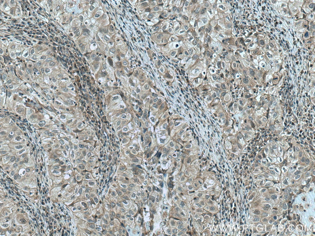 JNK Antibody in Immunohistochemistry (Paraffin) (IHC (P))