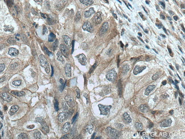 JNK Antibody in Immunohistochemistry (Paraffin) (IHC (P))