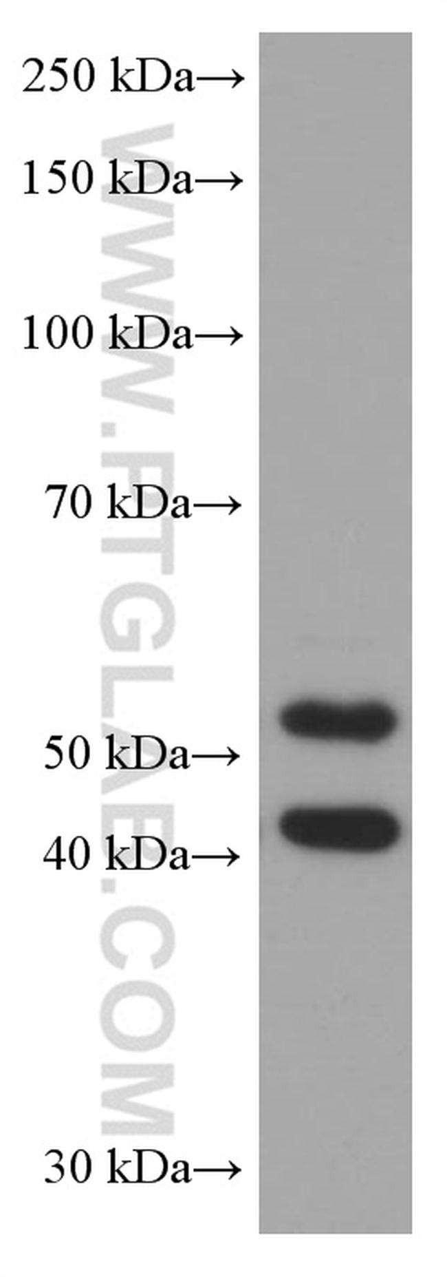 JNK Antibody in Western Blot (WB)