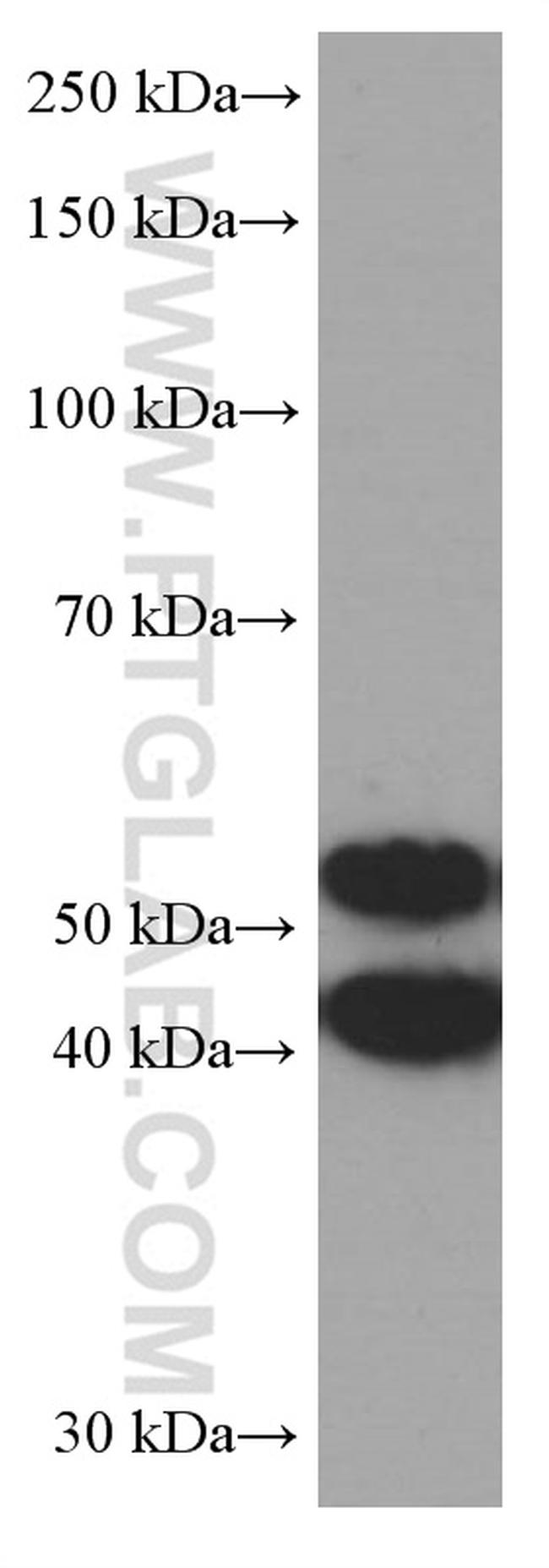 JNK Antibody in Western Blot (WB)