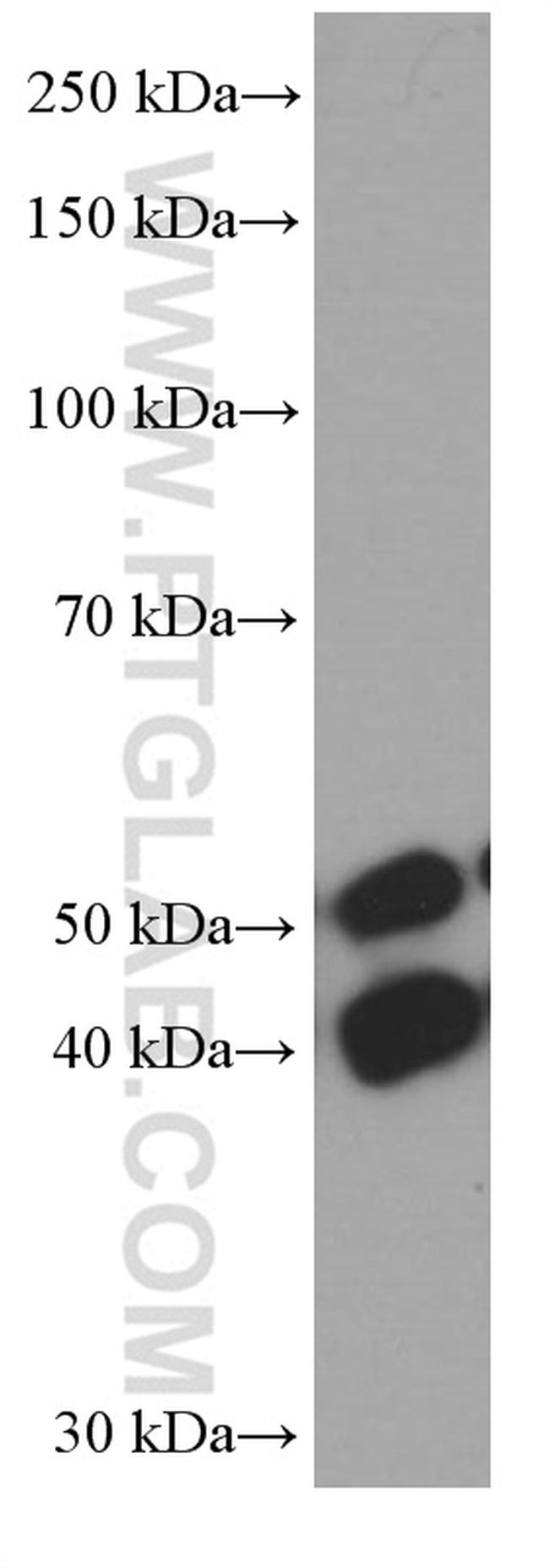 JNK Antibody in Western Blot (WB)