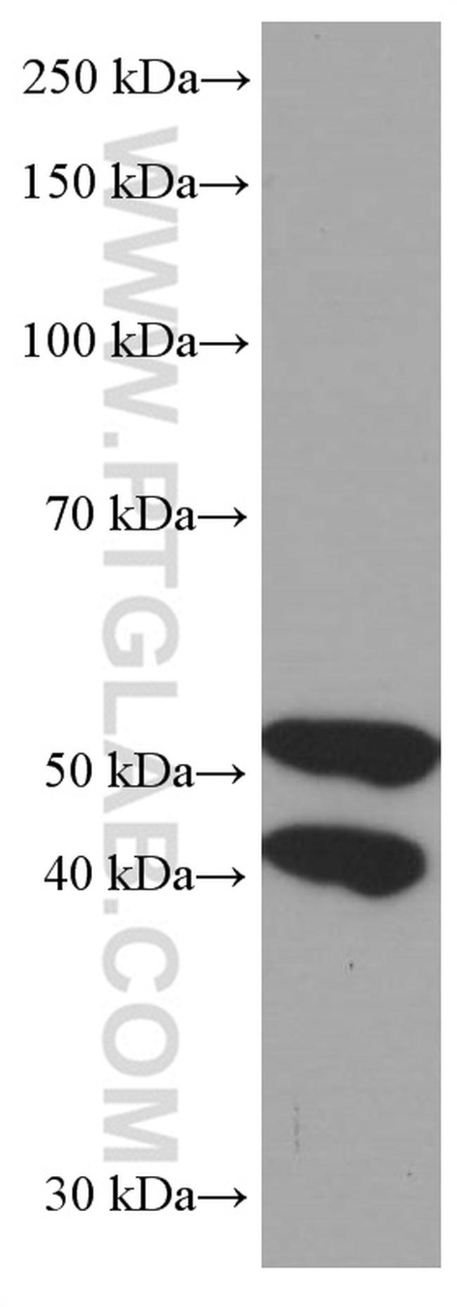 JNK Antibody in Western Blot (WB)