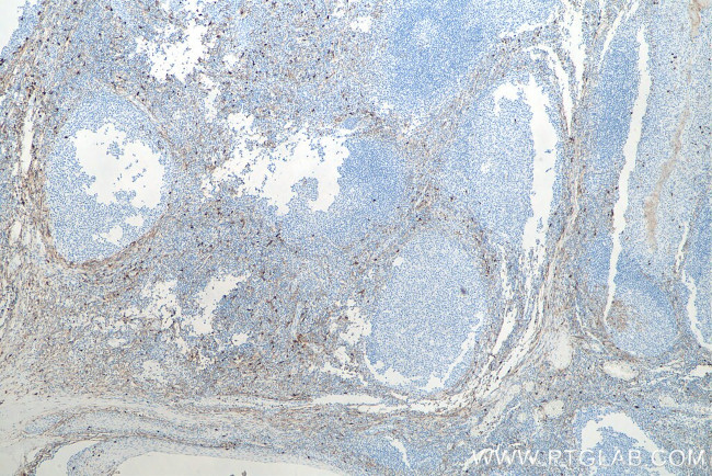 CD13 Antibody in Immunohistochemistry (Paraffin) (IHC (P))