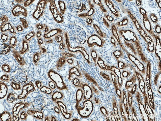 CD13 Antibody in Immunohistochemistry (Paraffin) (IHC (P))