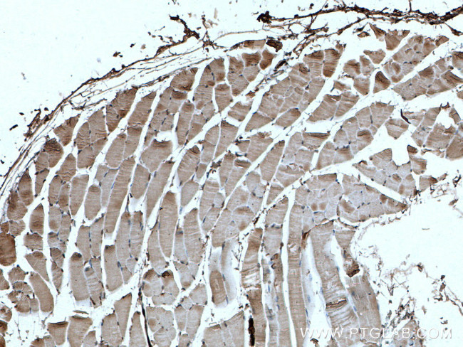 MYH2 Antibody in Immunohistochemistry (Paraffin) (IHC (P))