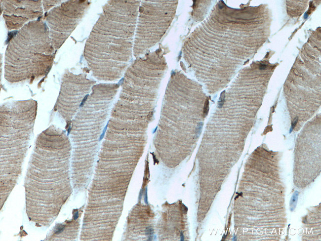 MYH2 Antibody in Immunohistochemistry (Paraffin) (IHC (P))