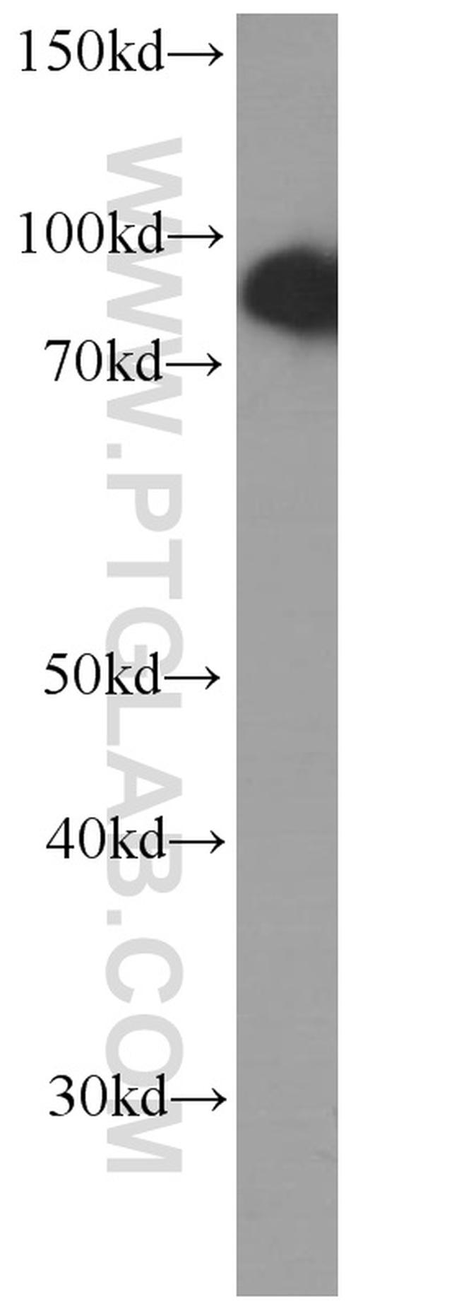 USP5 Antibody in Western Blot (WB)