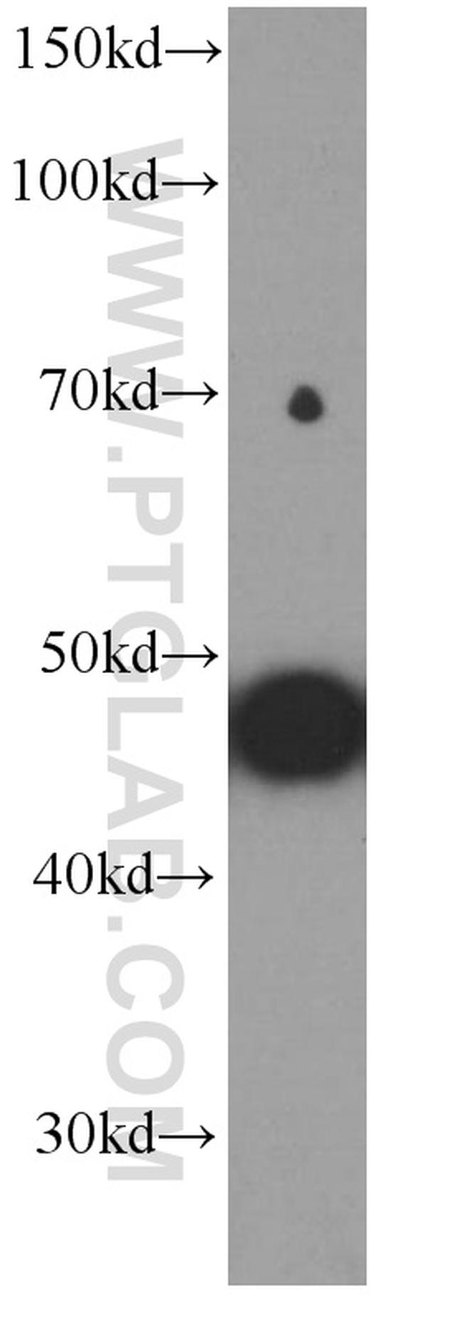 MYOD1 Antibody in Western Blot (WB)