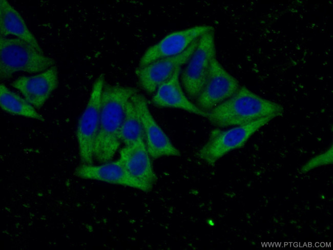 ORM2 Antibody in Immunocytochemistry (ICC/IF)