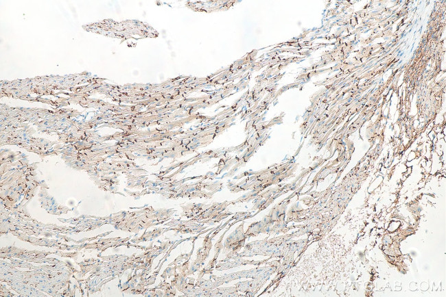 N-cadherin Antibody in Immunohistochemistry (Paraffin) (IHC (P))